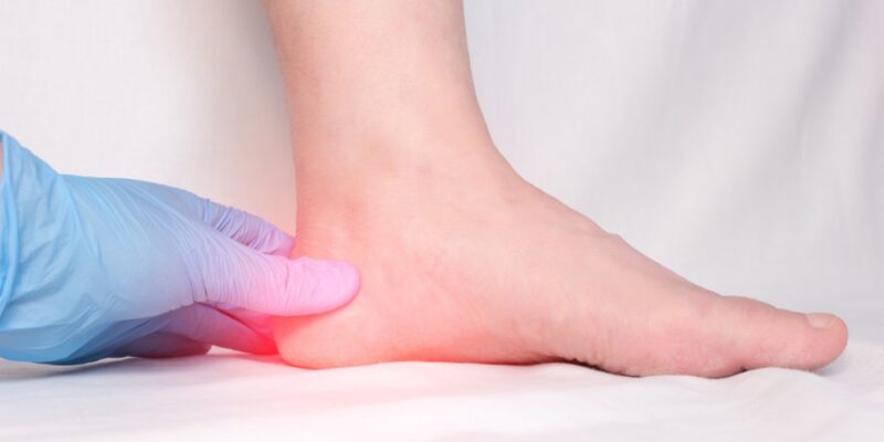 Cure Plantar Fasciitis