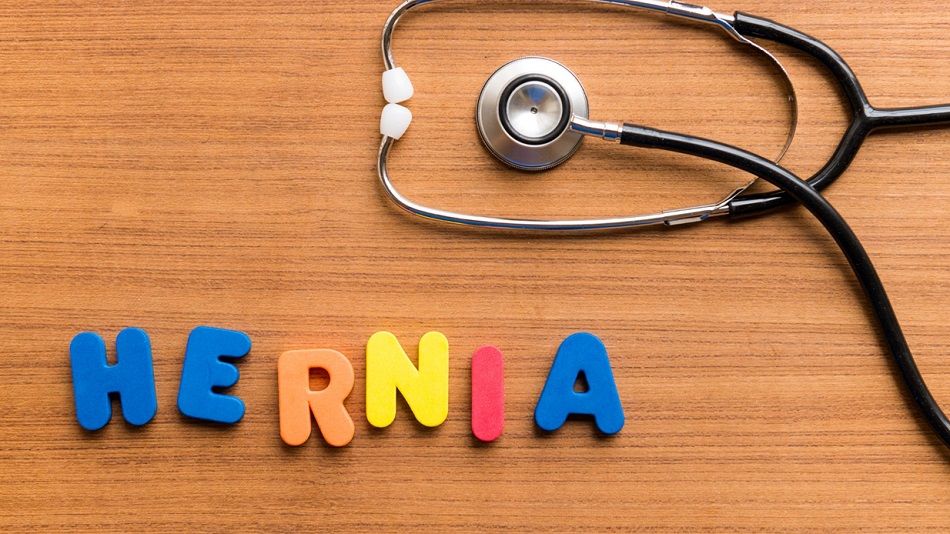 What Will Happen When You Leave Hernia Untreated? Health Trumpet